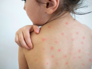 Pide Secretar&iacute;a de Salud revisar Cartilla de Vacunaci&oacute;n